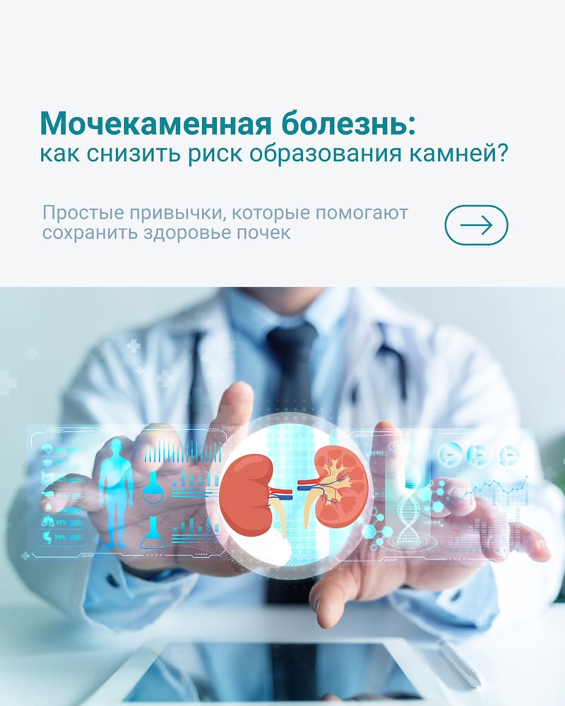 Мочекаменная болезнь: как снизить риск образования камней?