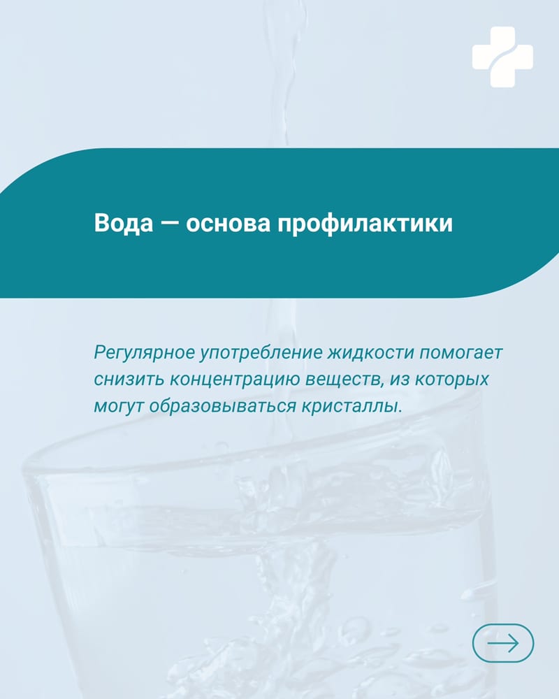 Мочекаменная болезнь: как снизить риск образования камней?